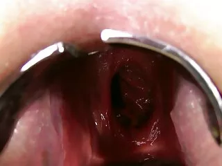 Corbata-cáncer, videos de sexo amateur reales oro
